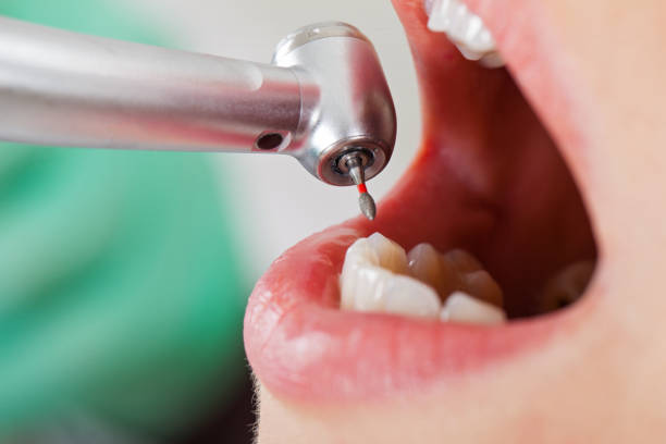 Best Broken or Chipped Tooth Repair in Rtez, CO